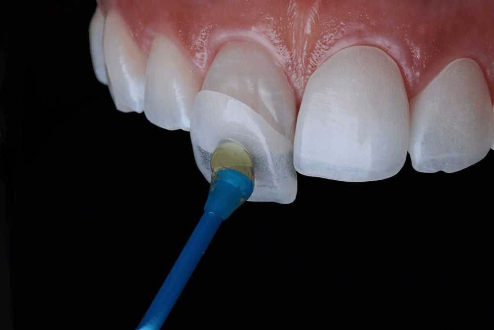 zuby hygiena